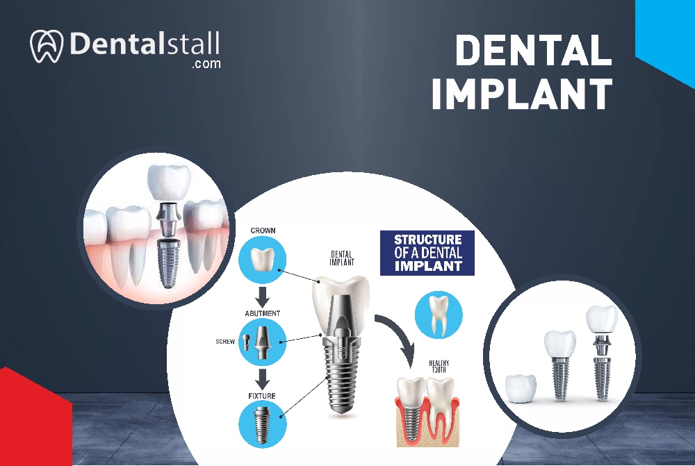 dental stall best store for dental equipment