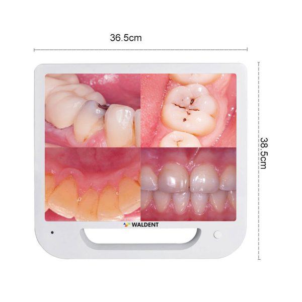 Waldent Intra Oral Camera with Screen - Ergo (10 MP) - Dentalstall India