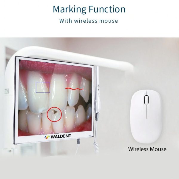 Waldent Intraoral Camera with Monitor Walcam - Dentalstall India