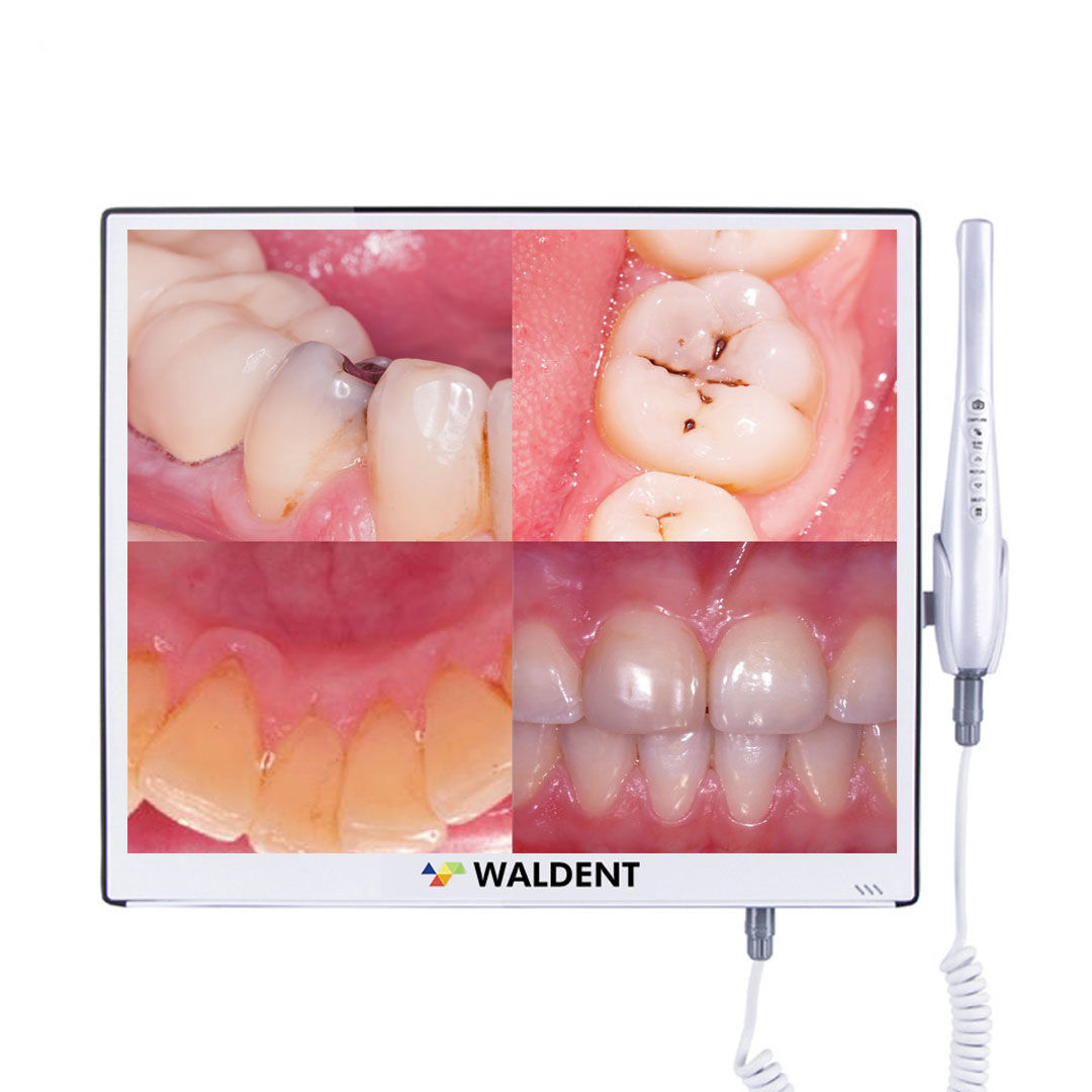Waldent Intraoral Camera with Monitor Walcam