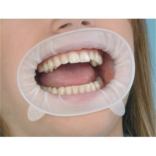 Ivoclar Optragate (Pack Of 5) - Dentalstall India