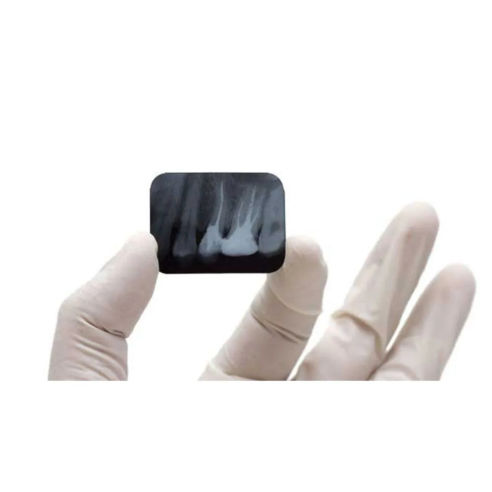 Waldent Dental X-Ray Film IOPA (Pack Of 100) - Dentalstall India