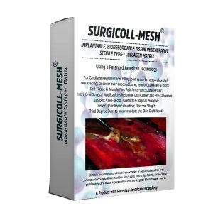 Advance Biotech Surgicoll Mesh - Dentalstall India