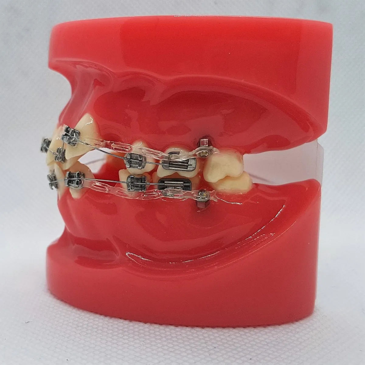 D-Tech Bondable Buccal Tubes - Dentalstall India