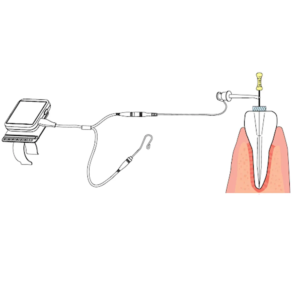 Woodpecker Apex Locator Accessories - Dentalstall India Woodpecker Apex Locator Accessories - Dentalstall India