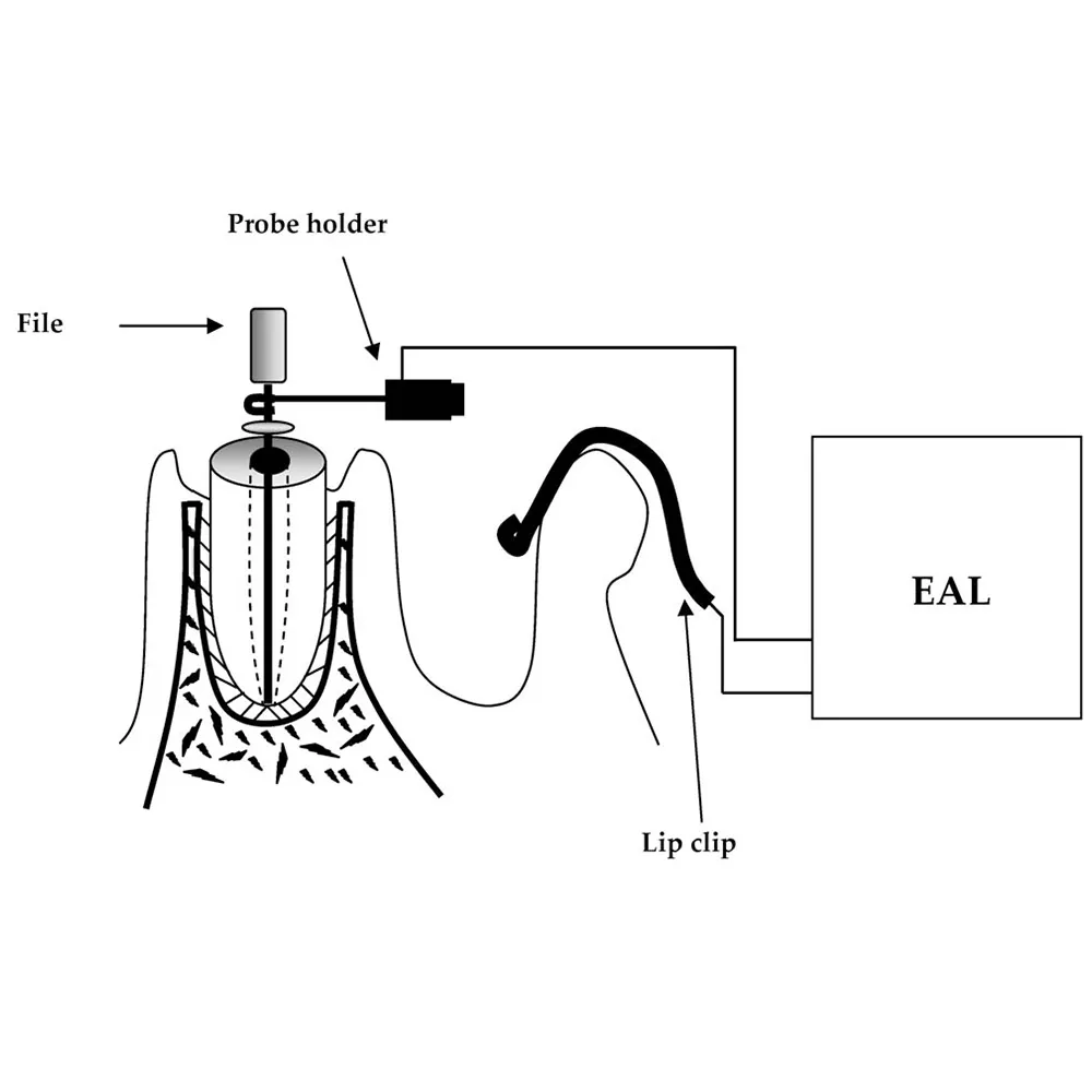 Woodpecker Apex Locator Accessories - Dentalstall India Woodpecker Apex Locator Accessories - Dentalstall India