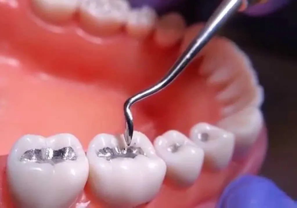 Dpi Fine Grain Dental Silver Alloy - Dentalstall India Dpi Fine Grain Dental Silver Alloy - Dentalstall India