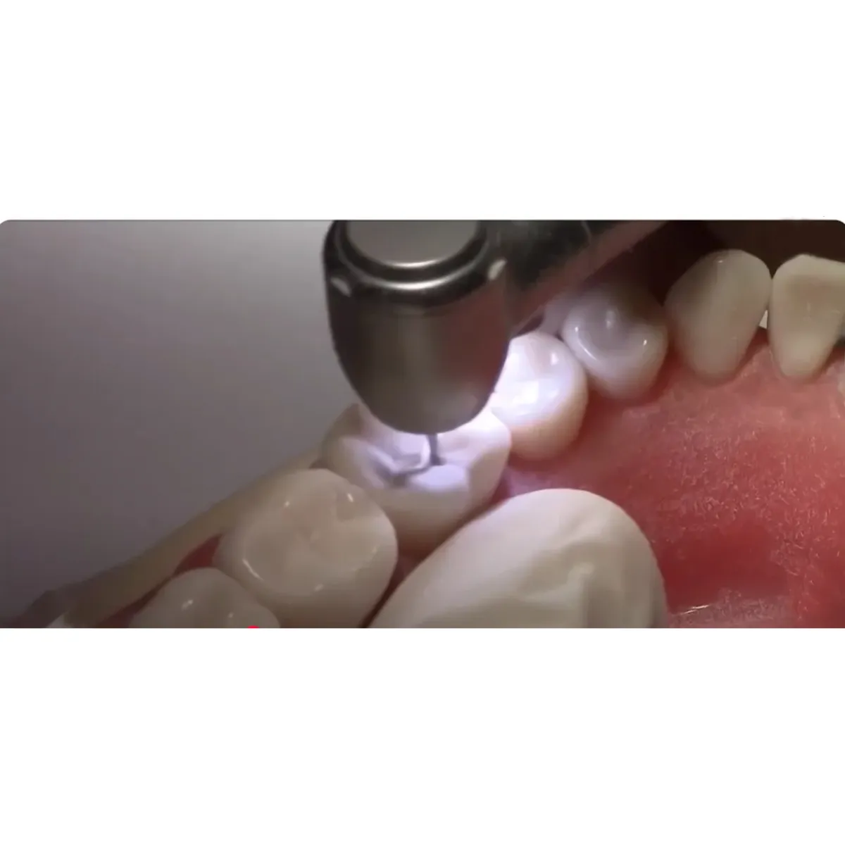 NSK S-Max M900L Airotor Handpiece - Dentalstall India NSK S-Max M900L Airotor Handpiece - Dentalstall India