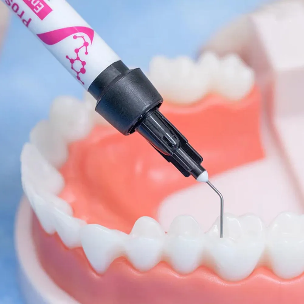 Vincismile Proseal F Pit & Fissure Sealant - Dentalstall India Vincismile Proseal F Pit & Fissure Sealant - Dentalstall India