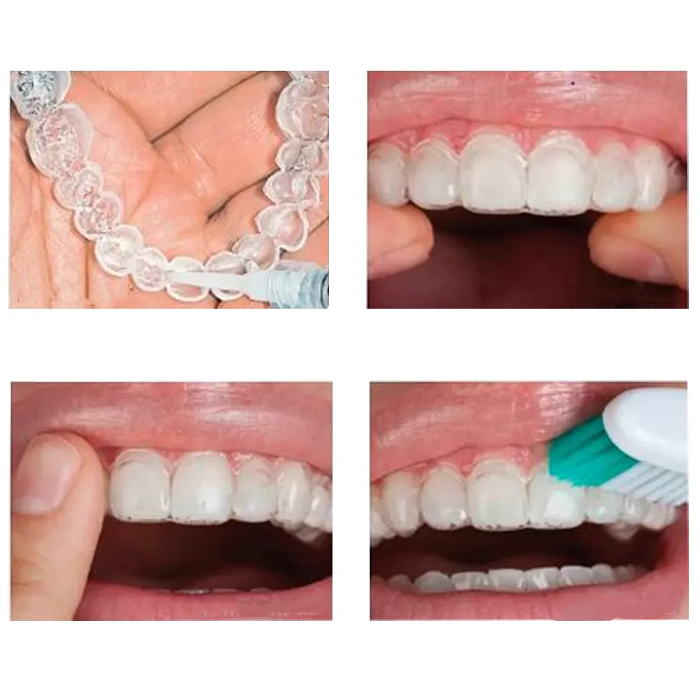 Maarc D Sens P (Desensitizing Agent with Potassium Nitrate) - Dentalstall India Maarc D Sens P (Desensitizing Agent with Potassium Nitrate) - Dentalstall India