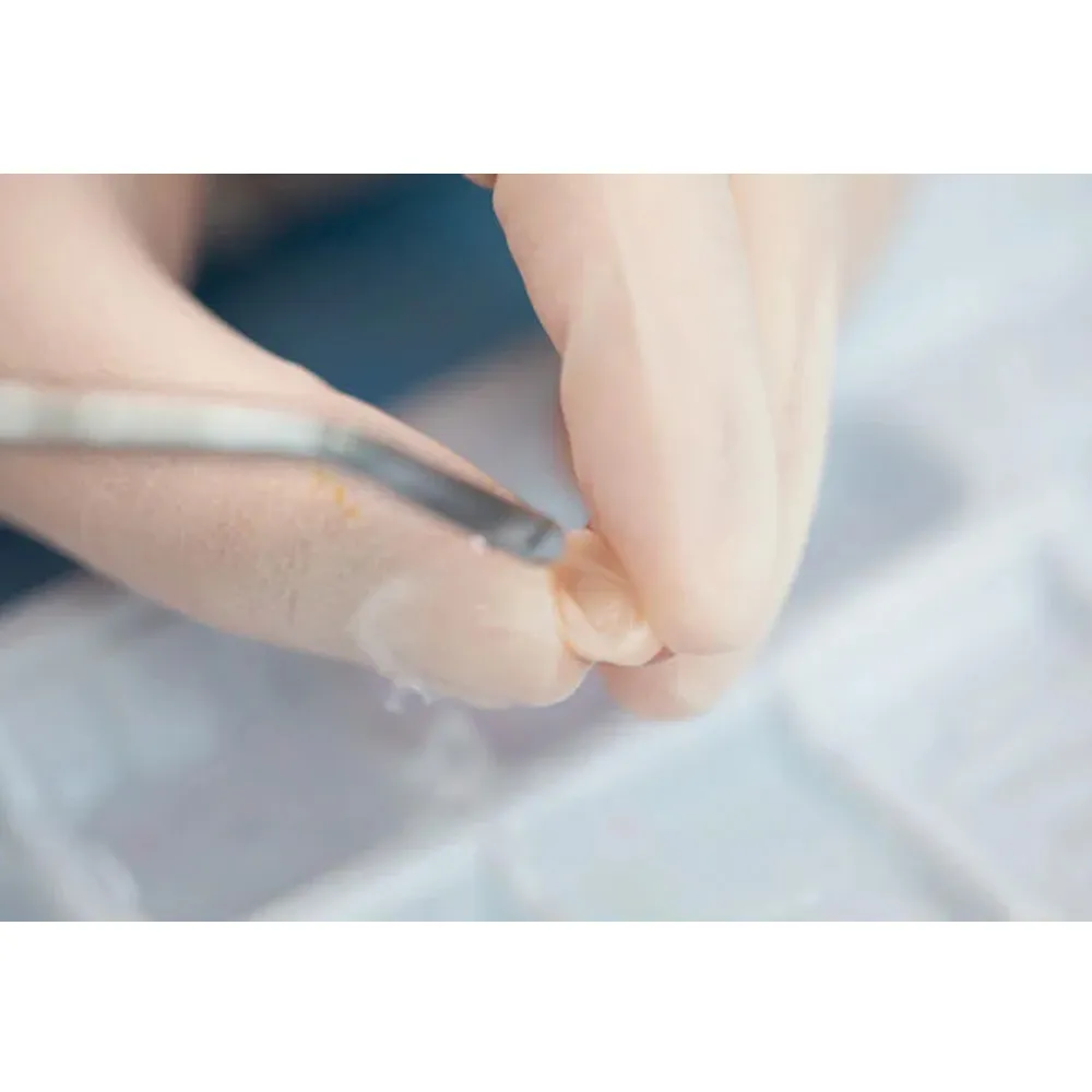 Vincismile HF-Etchant Hydrofluoric Acid Etching Gel - Dentalstall India Vincismile HF-Etchant Hydrofluoric Acid Etching Gel - Dentalstall India
