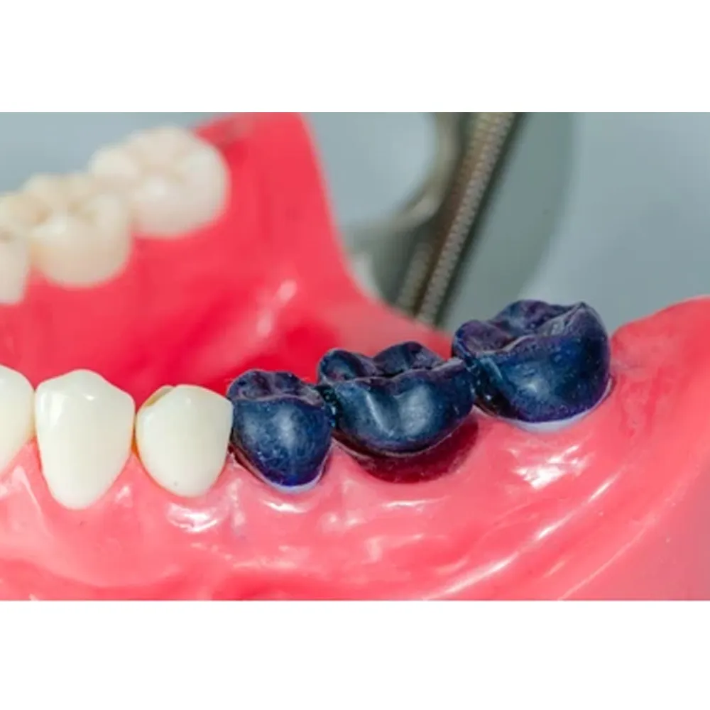 Maarc Inlay/Onlay Wax Sticks - Dentalstall India Maarc Inlay/Onlay Wax Sticks - Dentalstall India