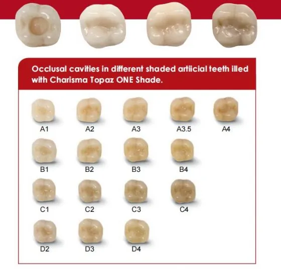 Kulzer Charisma Topaz One Shade Resin Based Restorative Composite Kit - Dentalstall India Kulzer Charisma Topaz One Shade Resin Based Restorative Composite Kit - Dentalstall India
