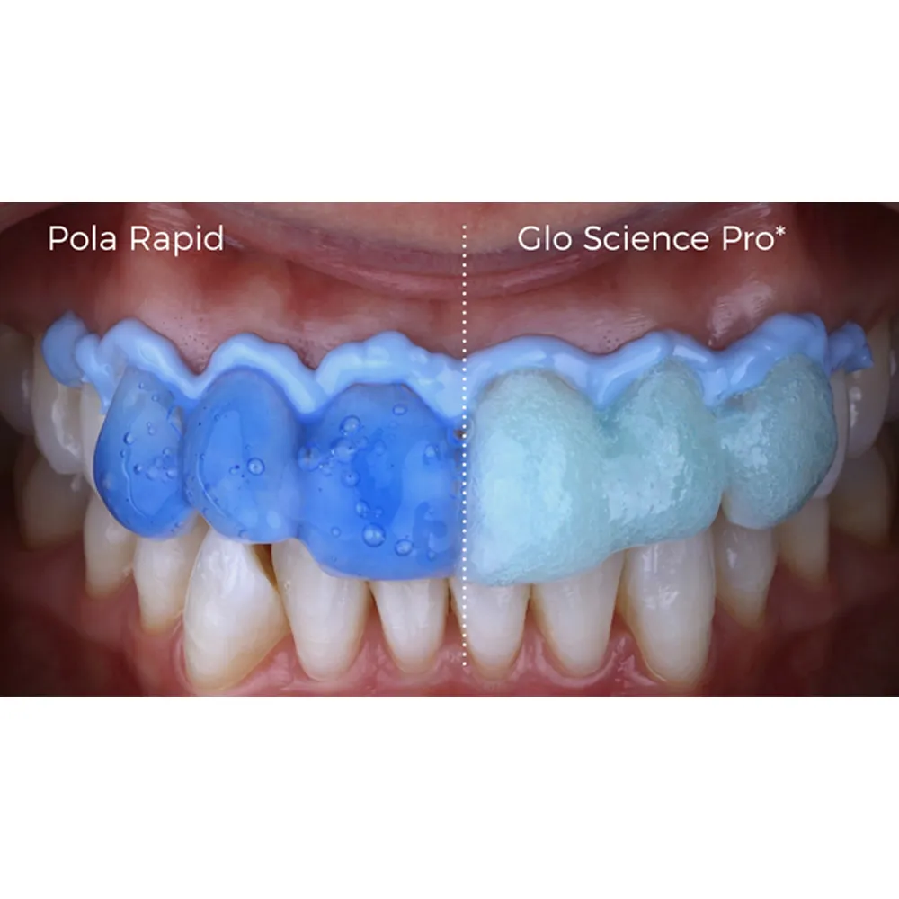 SDI Pola Rapid Advanced Tooth Whitening System - Dentalstall India SDI Pola Rapid Advanced Tooth Whitening System - Dentalstall India