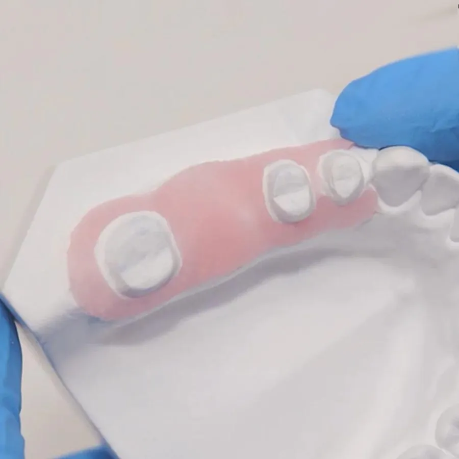 Vincismile Perfit A-Silicone Gingival Mask - Dentalstall India Vincismile Perfit A-Silicone Gingival Mask - Dentalstall India